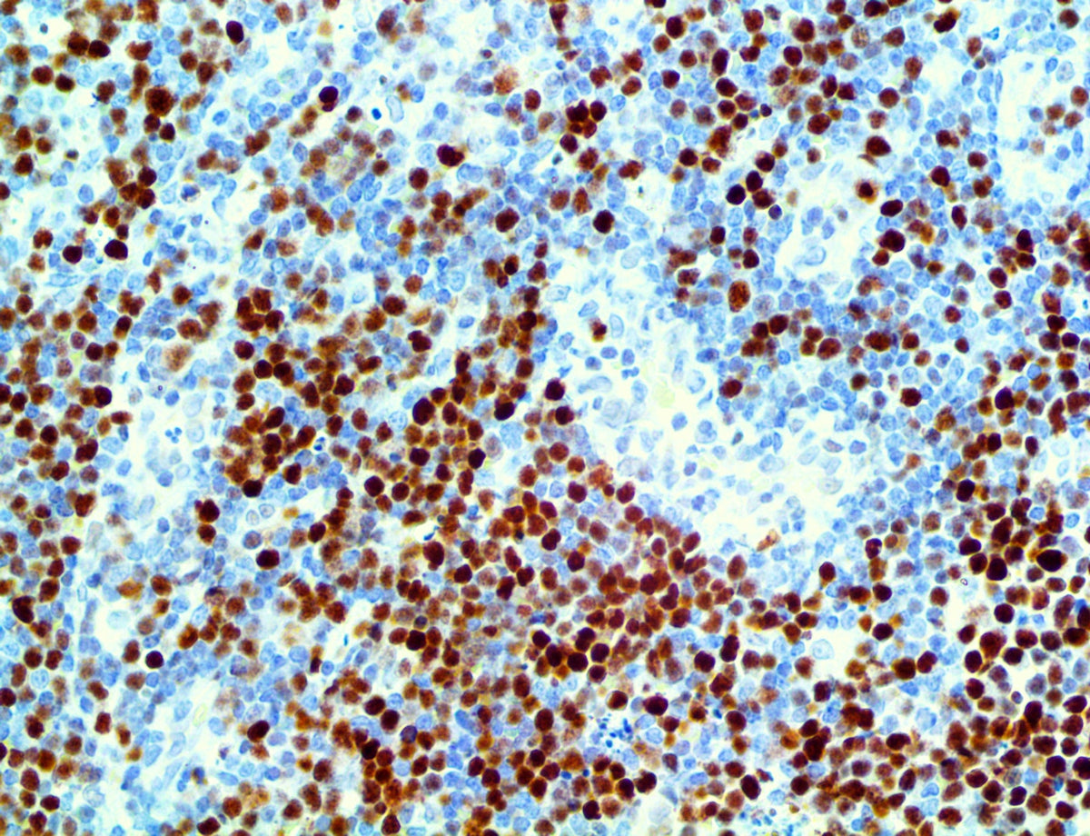 c-Myc