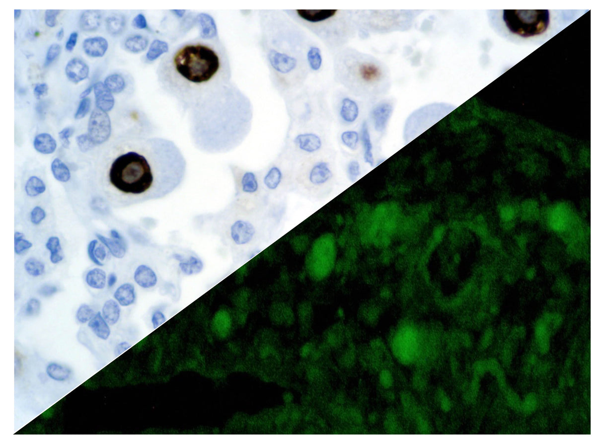 Cytomegalovirus