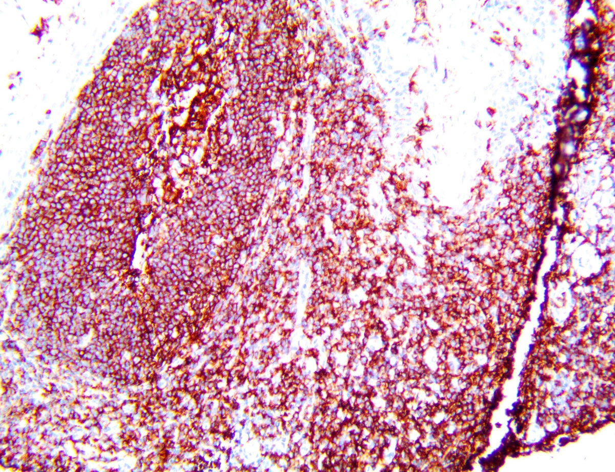 CD19