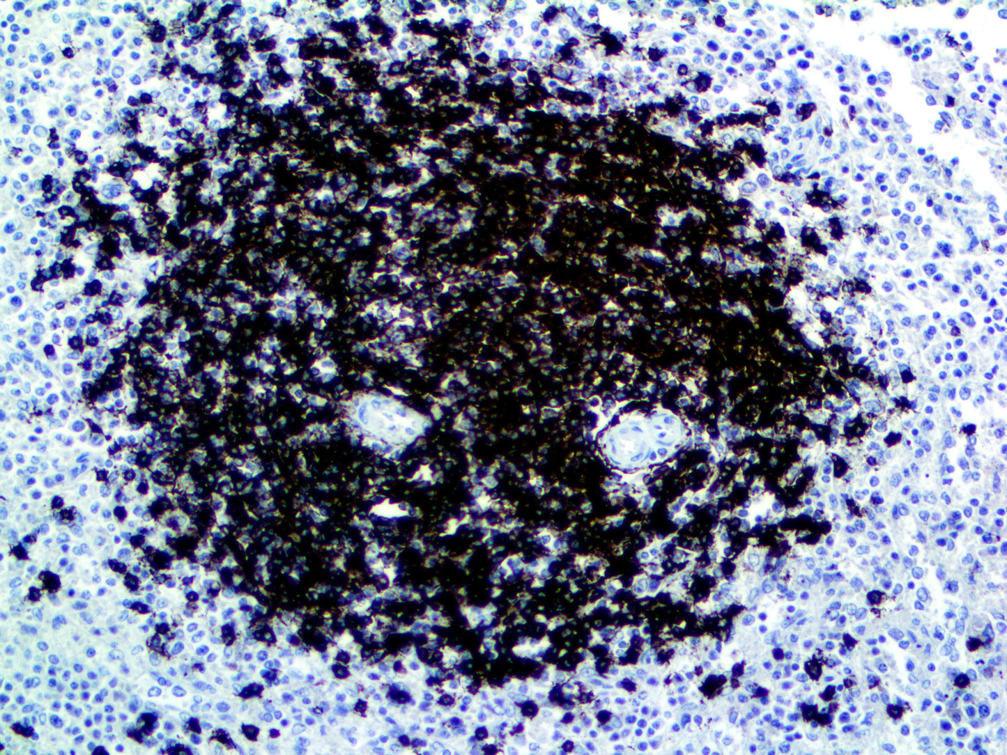 PolyDetector HRP Black