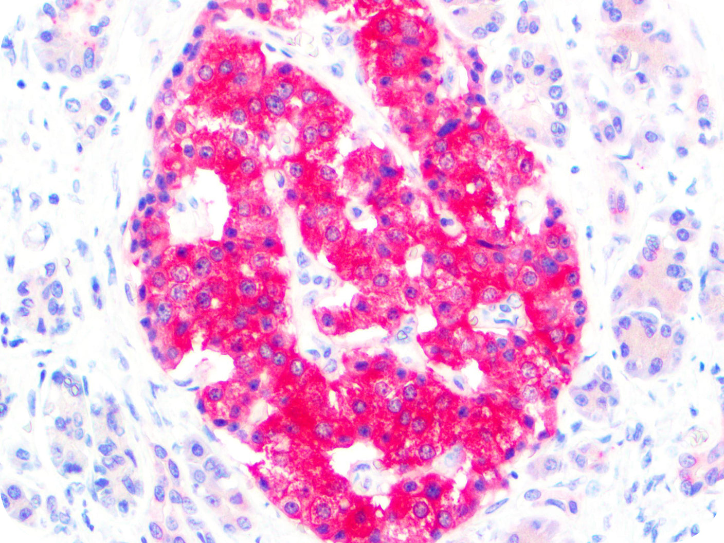 PolyDetector Alk Magenta
