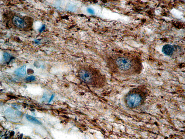 Neurofilament