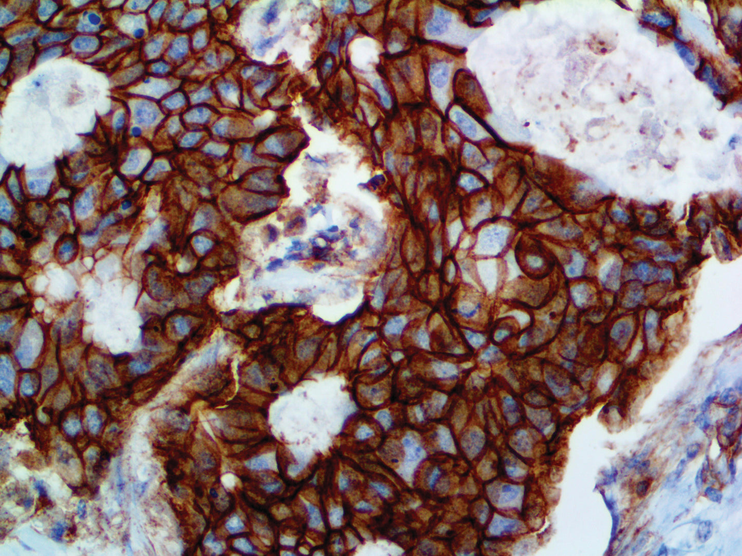 p120 Catenin