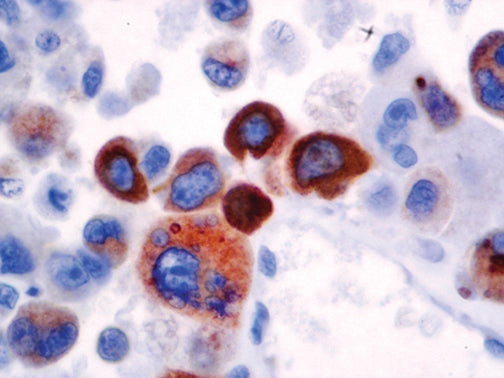 Prolactin