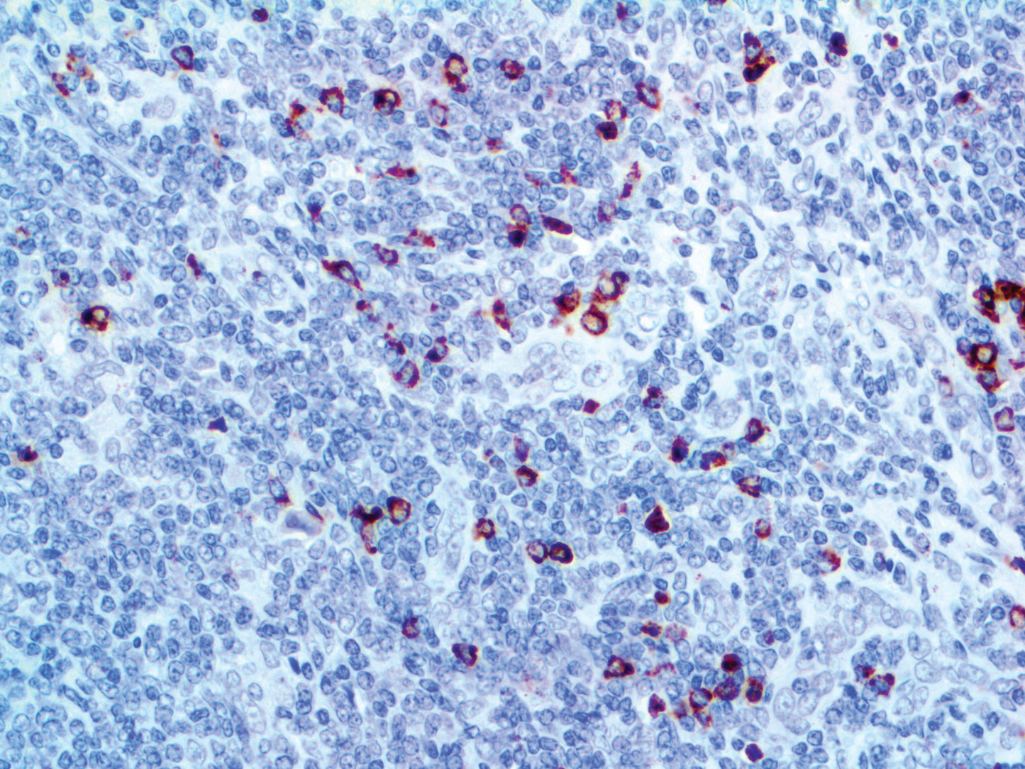 Granzyme B