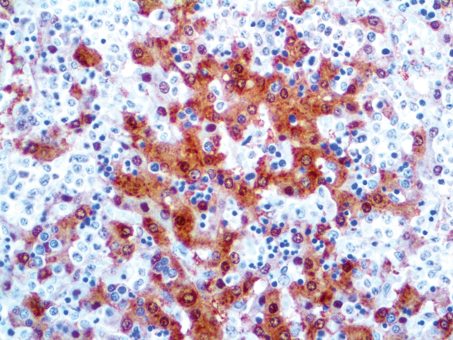Arginase-1
