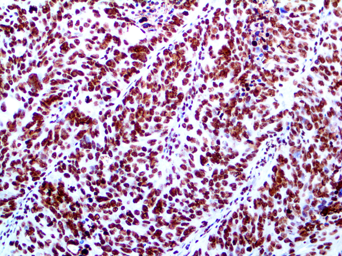 ERCC1