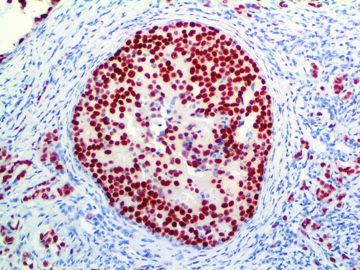 Estrogen Receptor