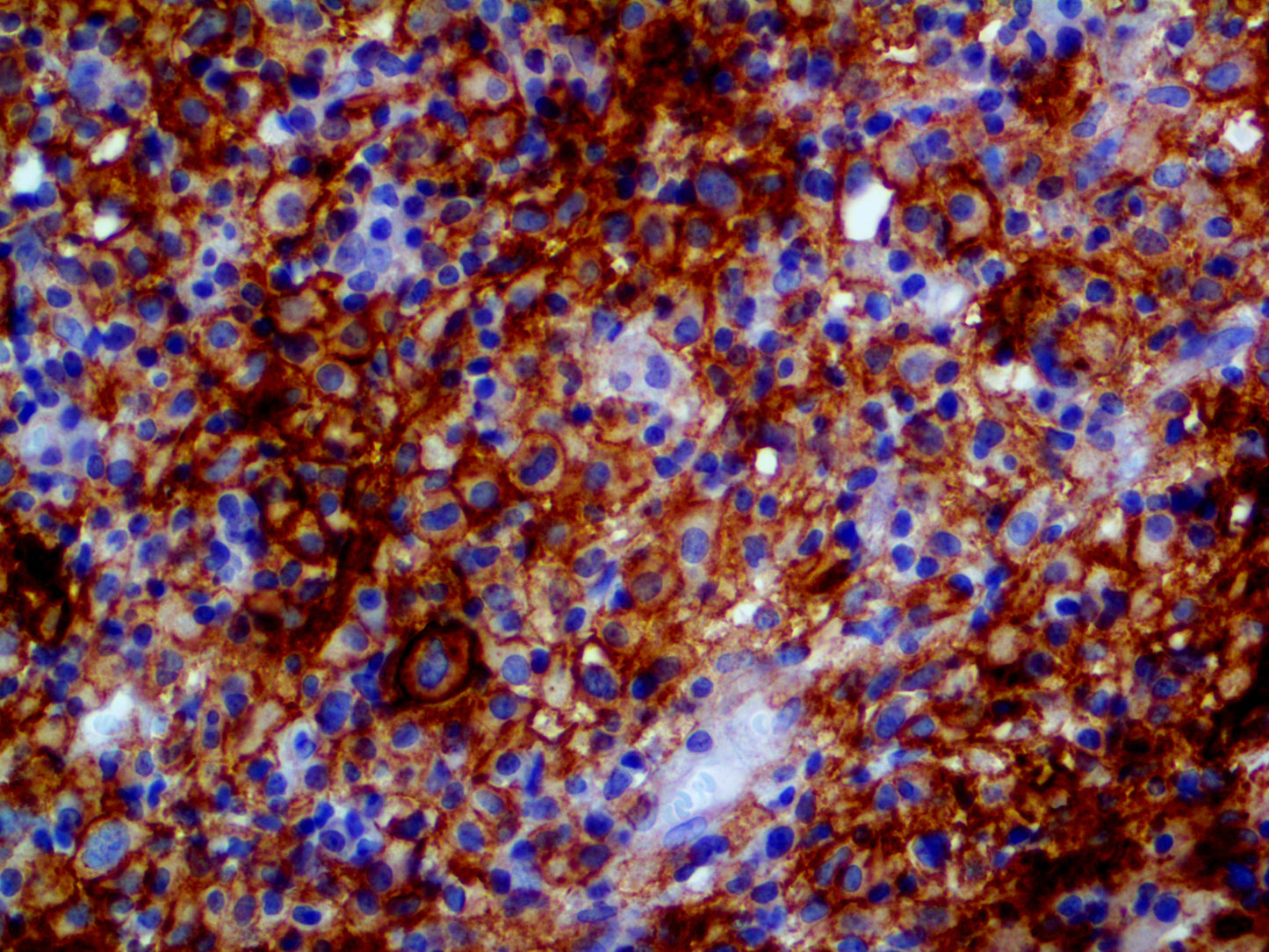 PD-L1/CD274