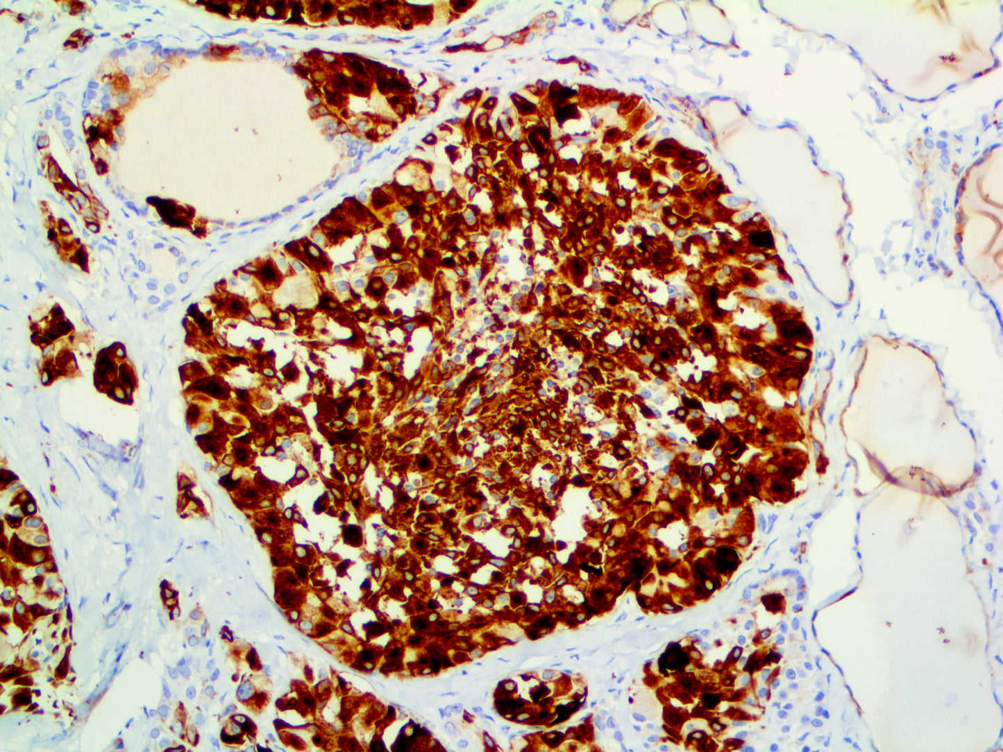 Cytokeratin 19