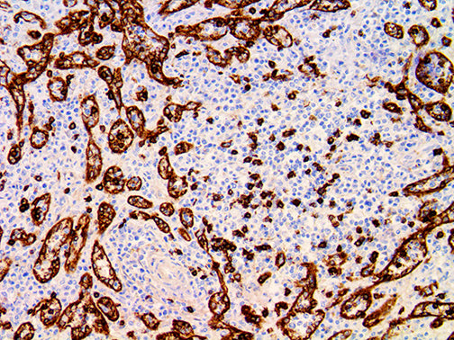 CD8