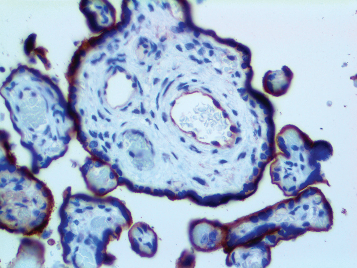 CD105/Endoglin
