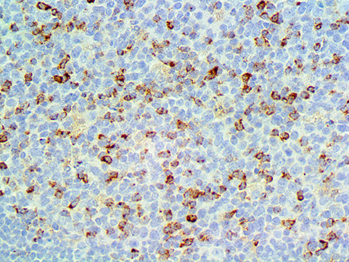 CTLA-4\CD152