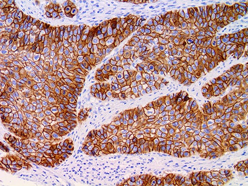 Desmoglein-3
