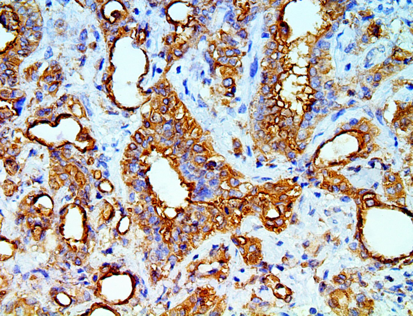 Mesothelial Cell
