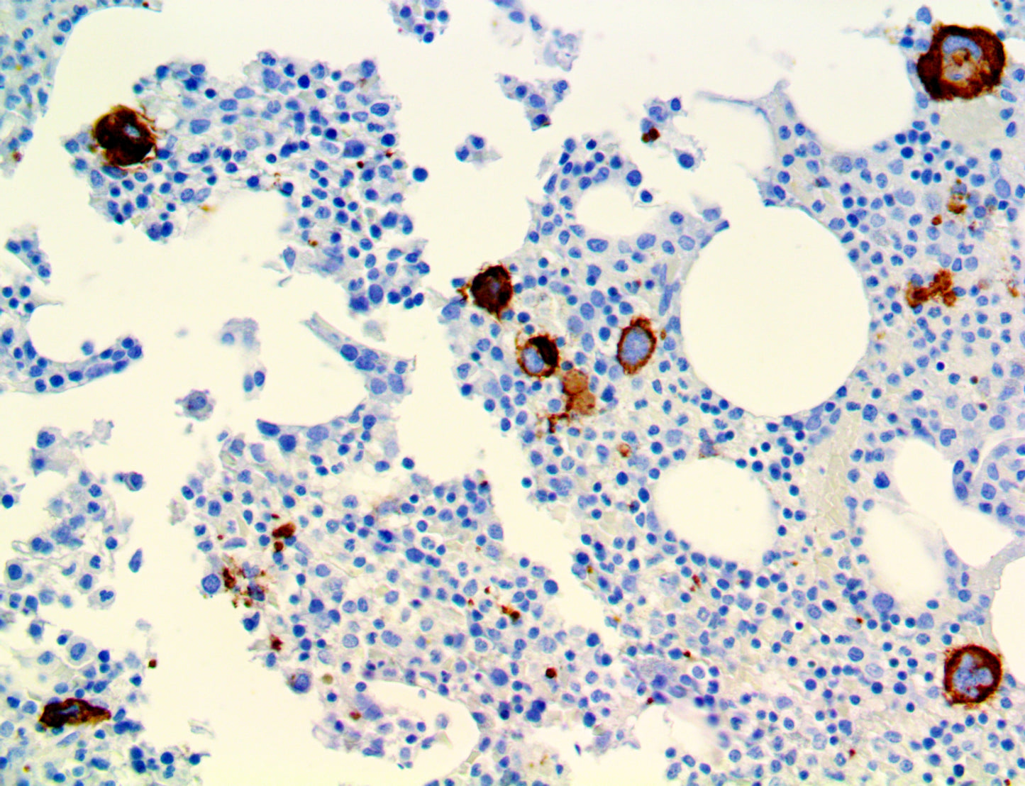 CD42b