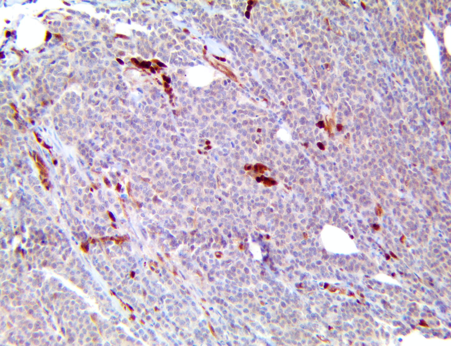 Caspase-3