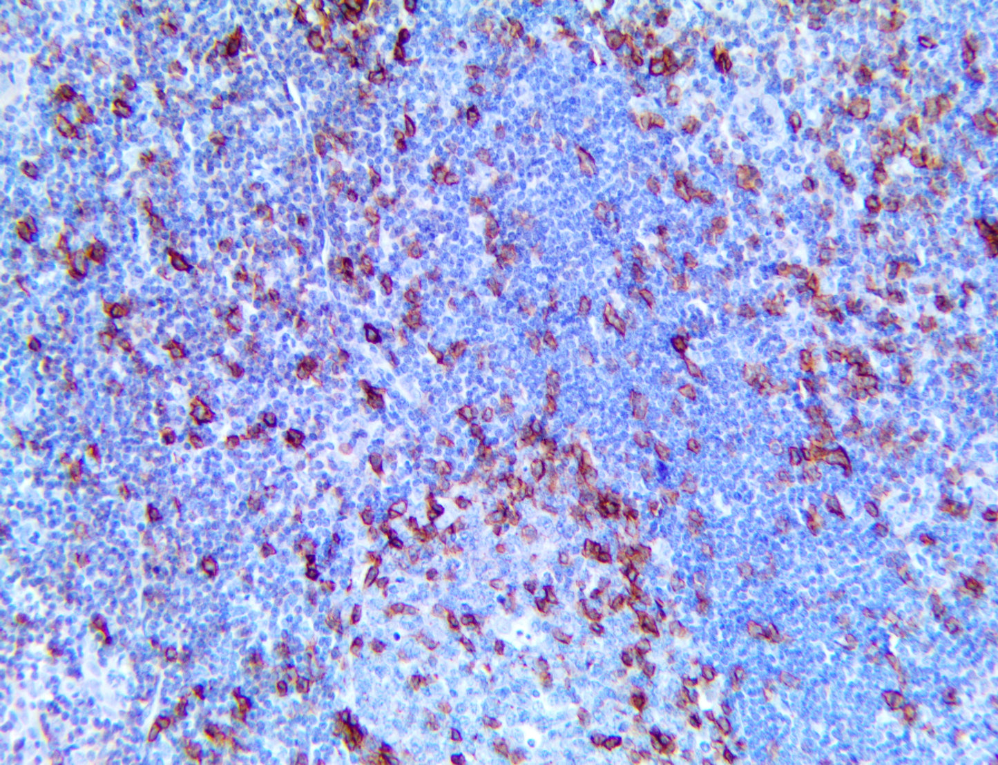 ICOS/CD278