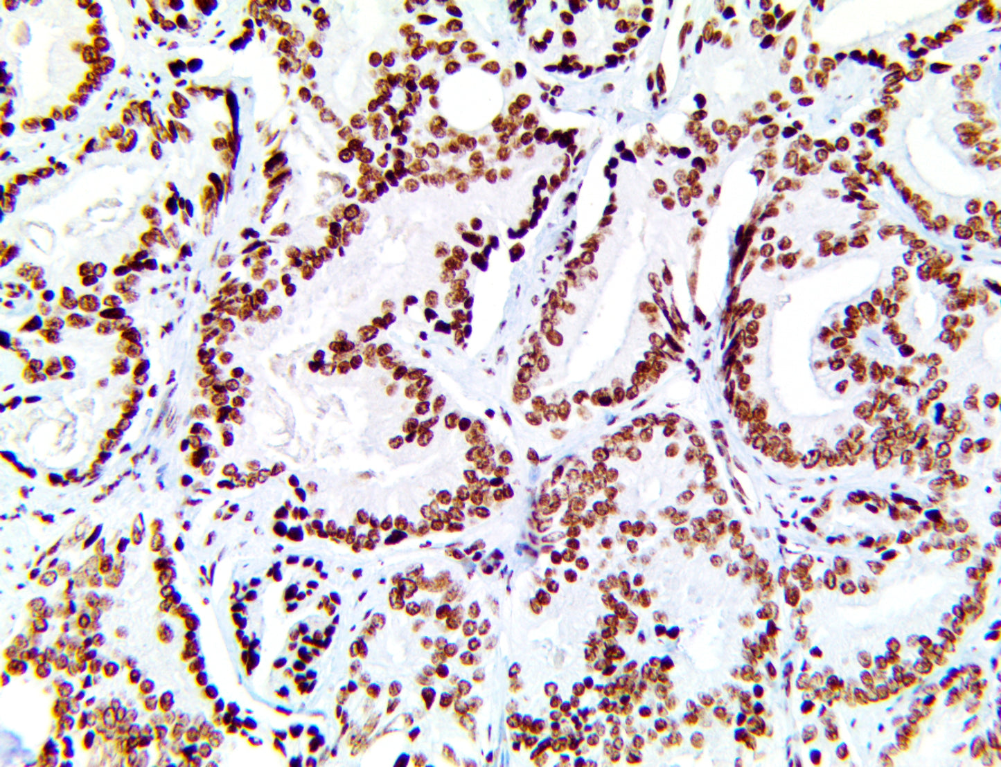 SF-1/Steroidogenic Factor 1