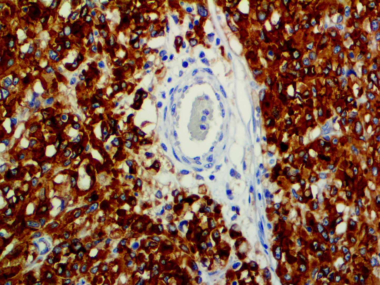 CD117