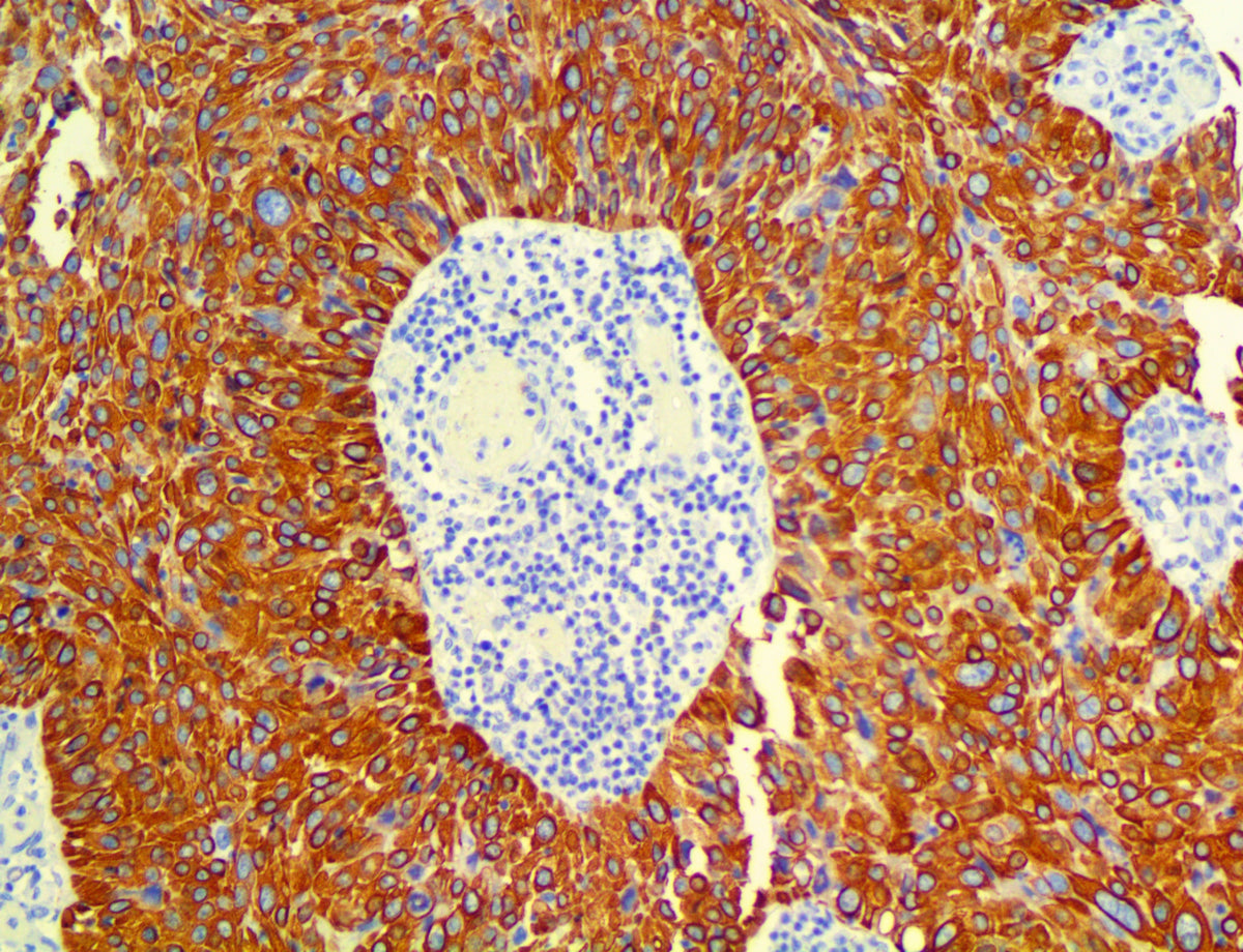 Cytokeratin 14