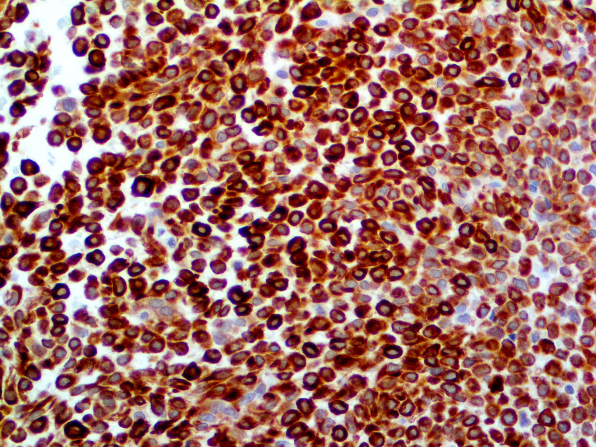 Cytokeratin 7
