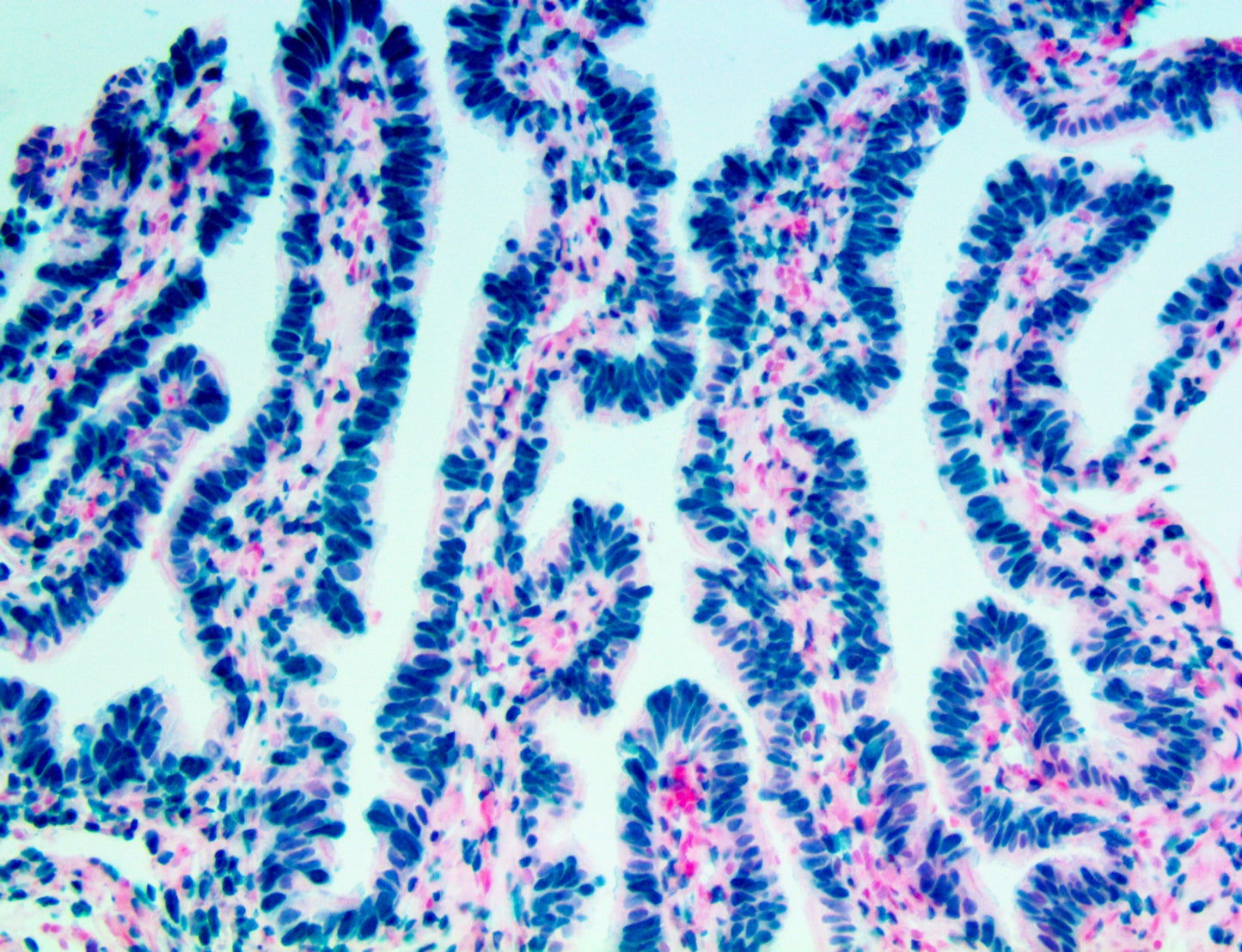 Estrogen Receptor