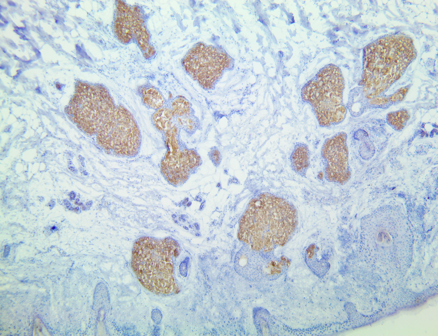 TintoFast Adipophilin