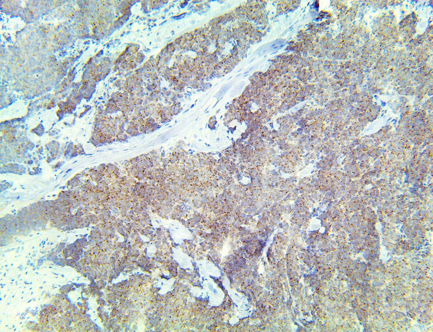 TintoFast Chromogranin A