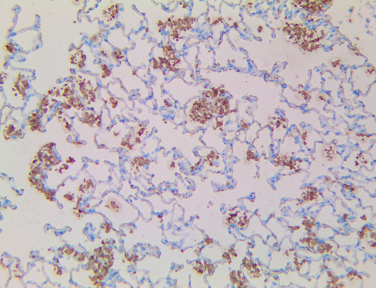Candida Albicans