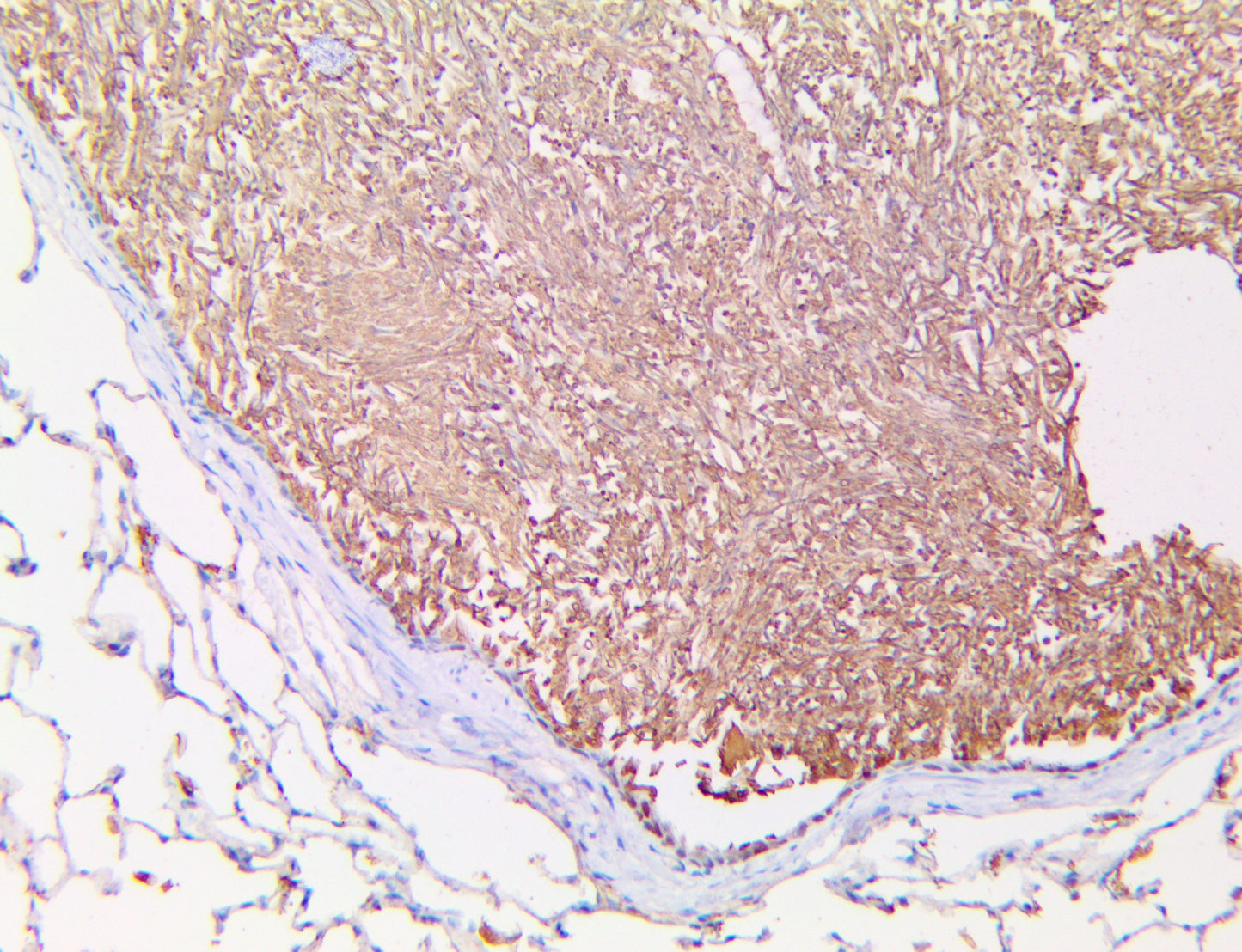 Aspergillus