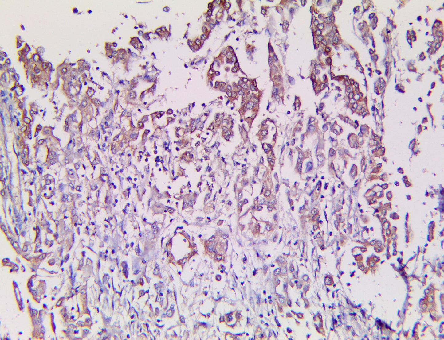 Calretinin