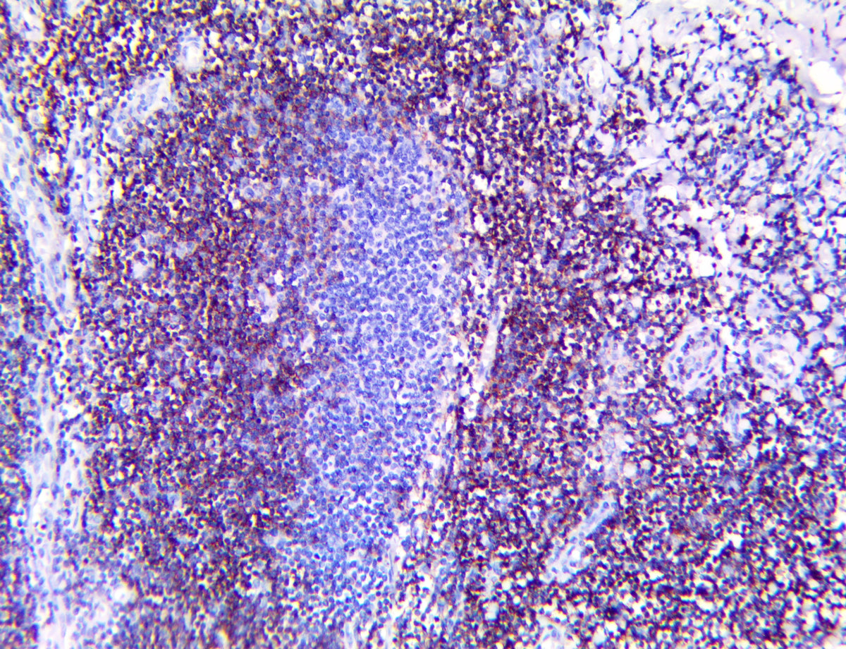 CD4