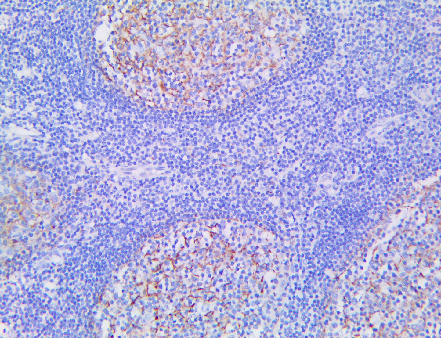 Clusterin/Apolipoprotein J