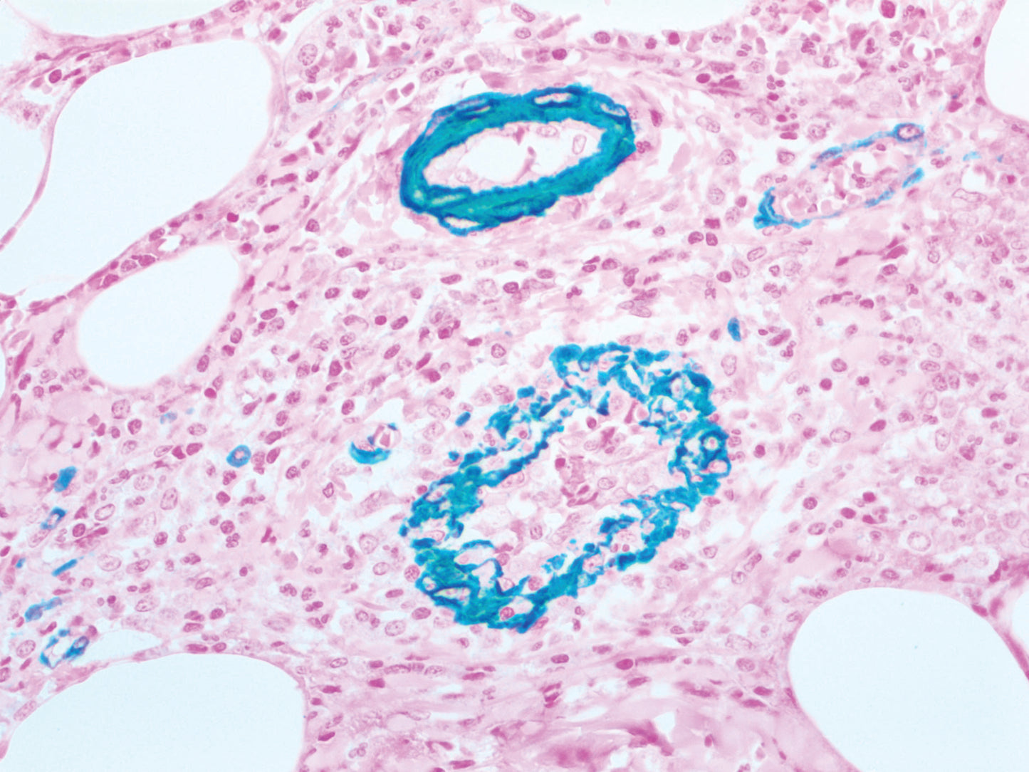 Actin Smooth Muscle