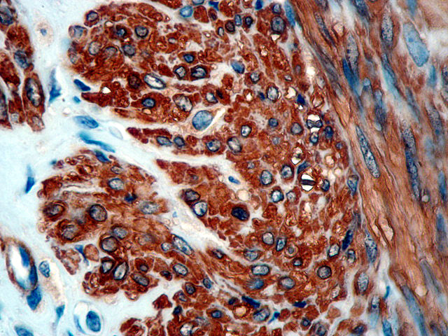 Calponin
