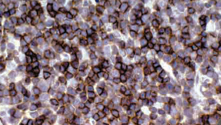 CD1a
