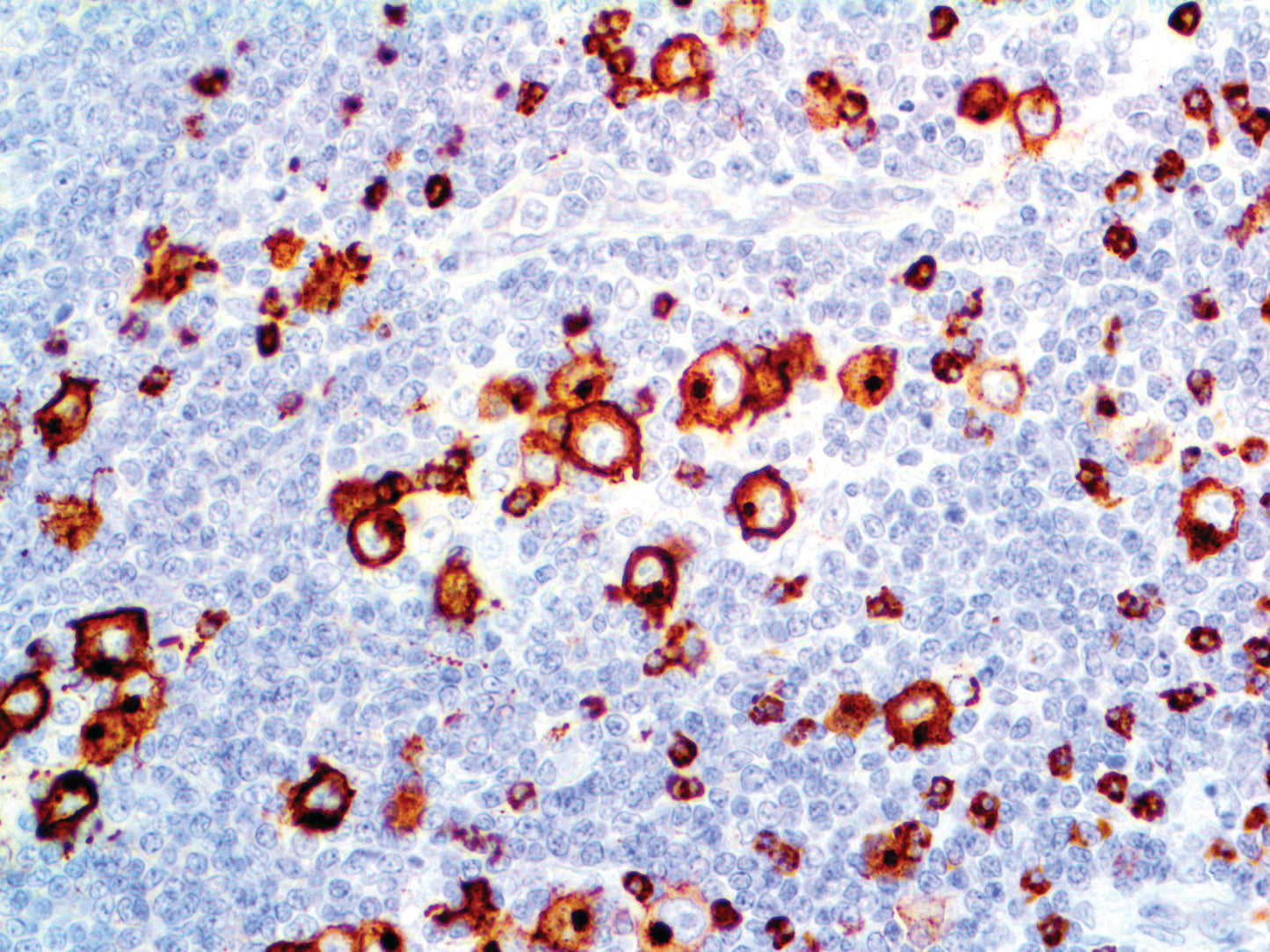 CD15