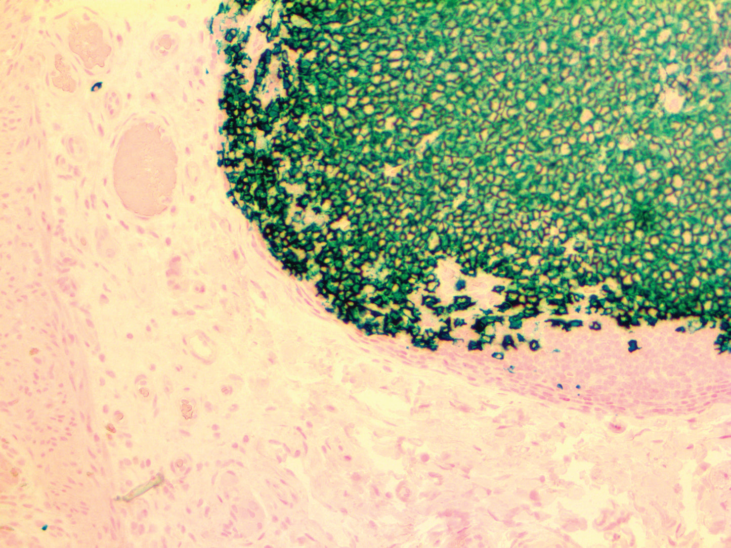 CD20