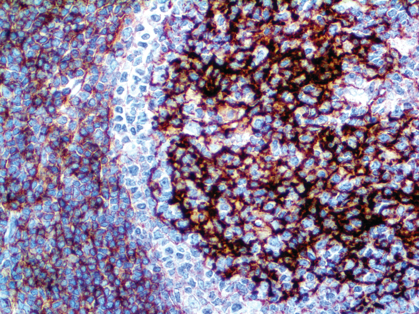 CD23