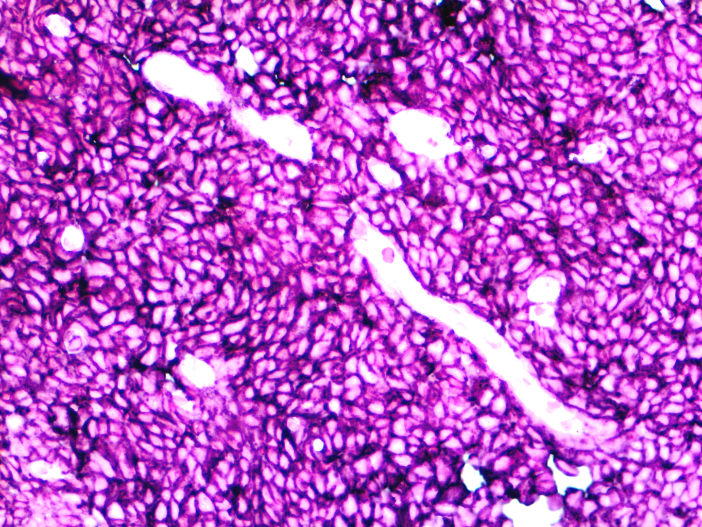 CD45
