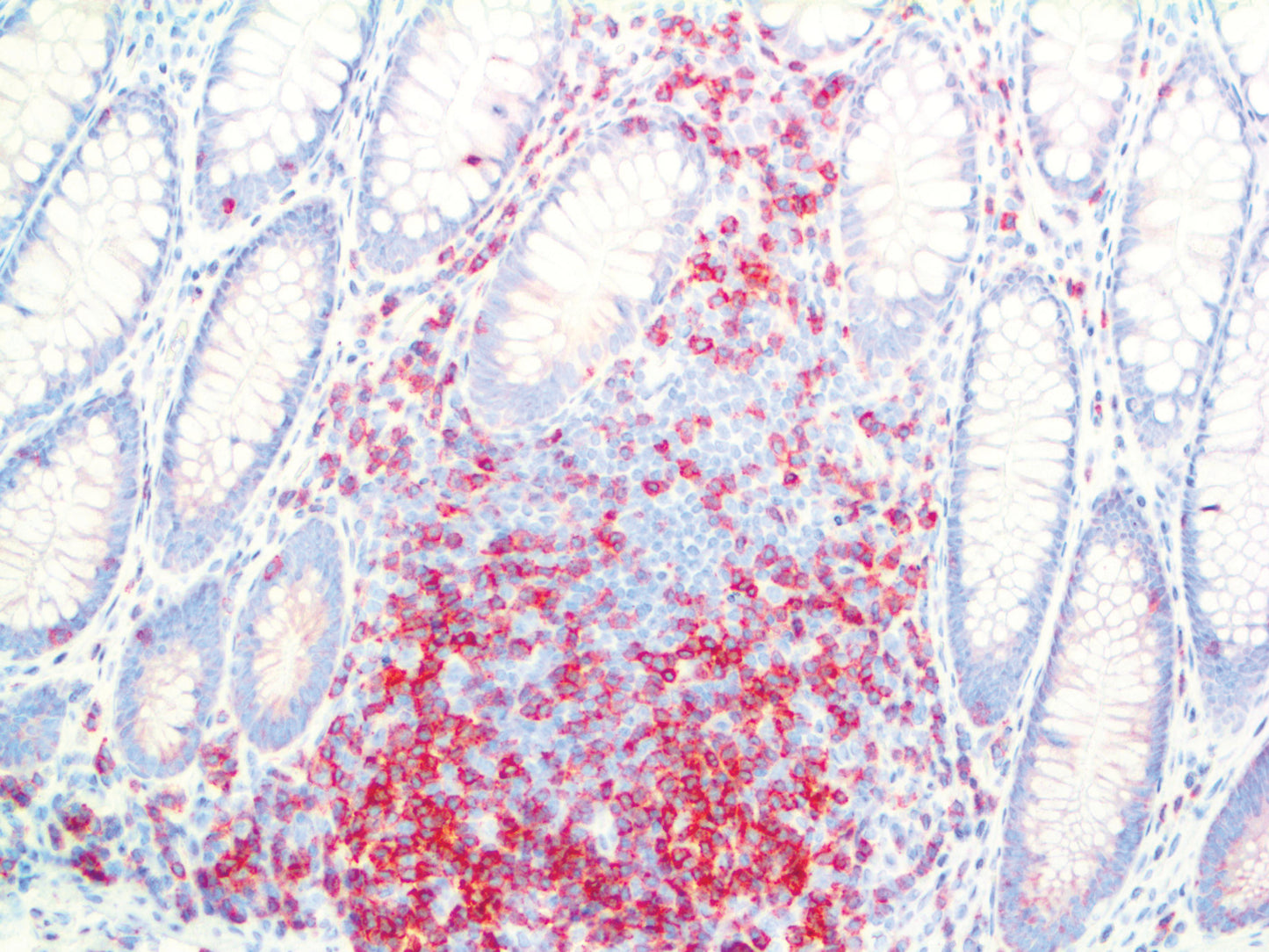 CD45RO