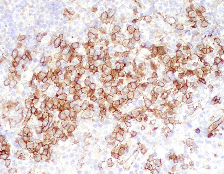 CD123 IL-3Ra