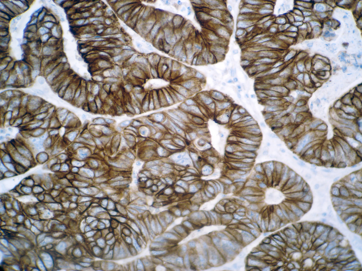 Cytokeratin 8 & 18