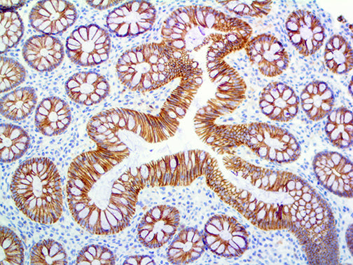 E-Cadherin