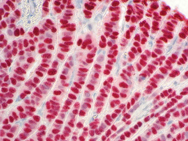 Estrogen Receptor