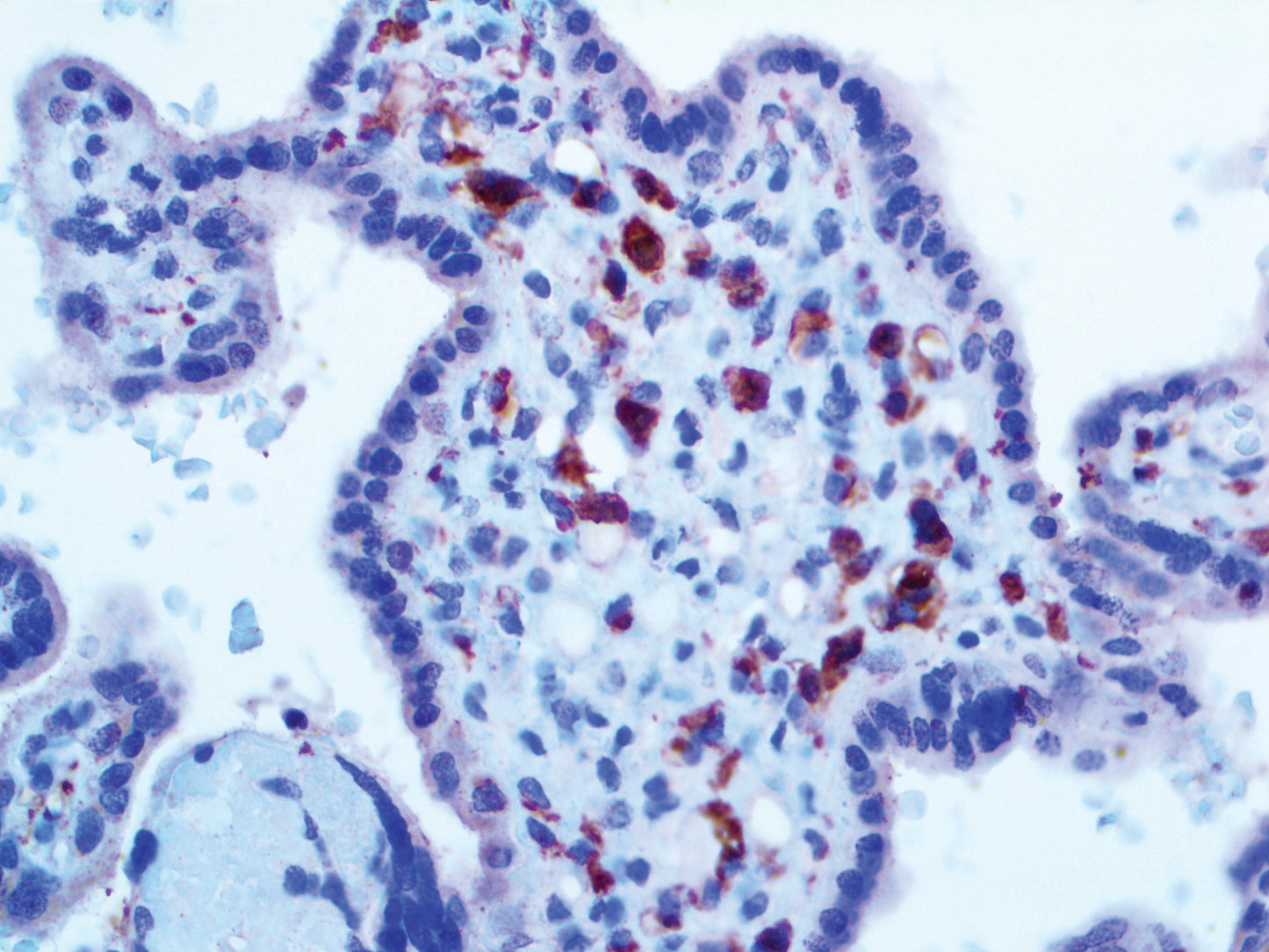 Factor XIIIa