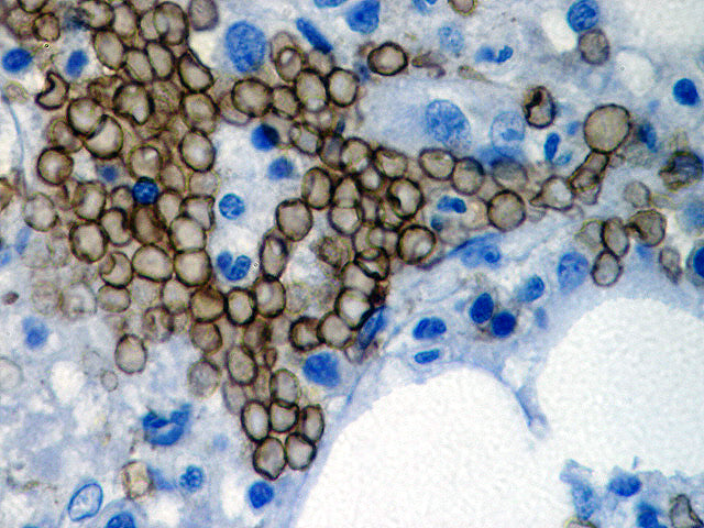 Glycophorin A (GA-R2