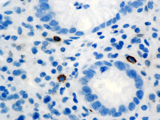 Tryptase