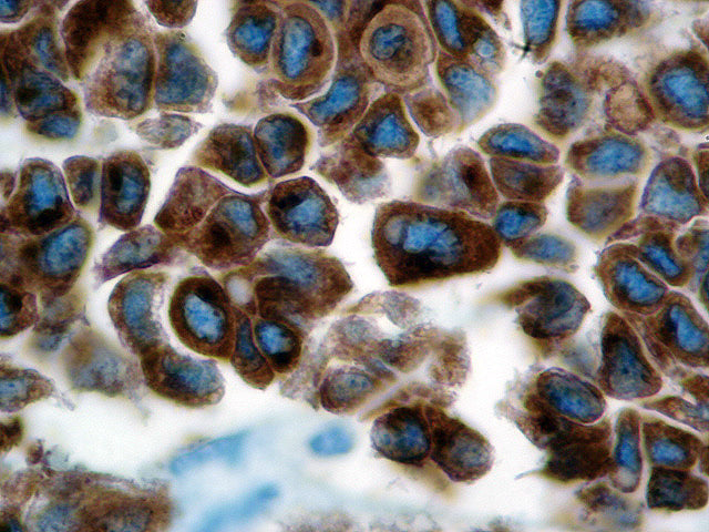 Tyrosinase